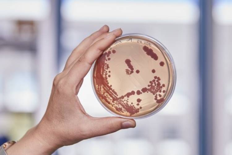 Insight Bacteriology Invites New Submissions: A Gateway to Global Microbial Research