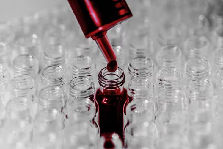 Breakthrough Blood Test Enhances Early Alzheimer’s Detection in Asian Populations