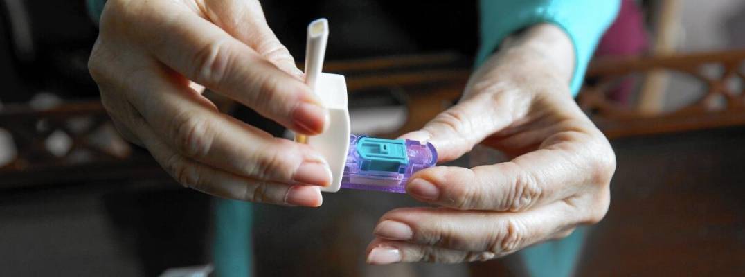 Inhaled Insulin Regimen Shows Promise for Managing Type 1 Diabetes Over 30 Weeks