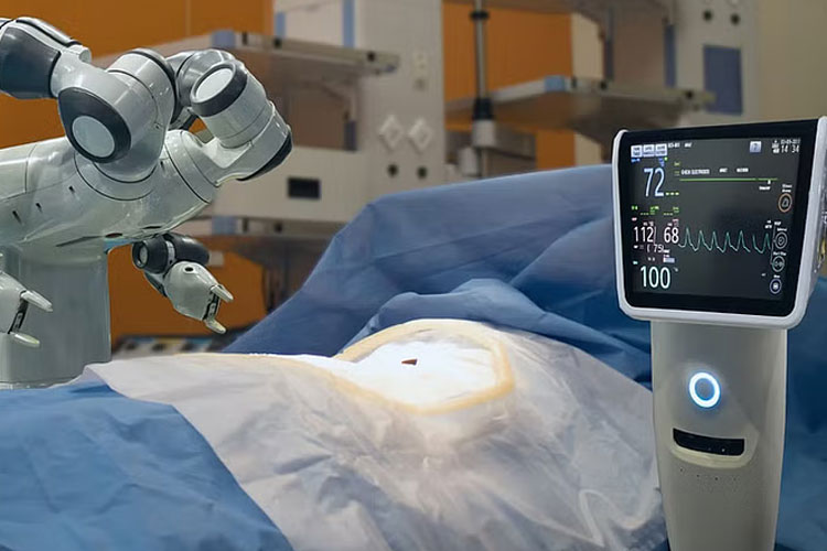 AI-Powered Knee Surgery Offers Better Outcomes for Patients with Bowed Legs